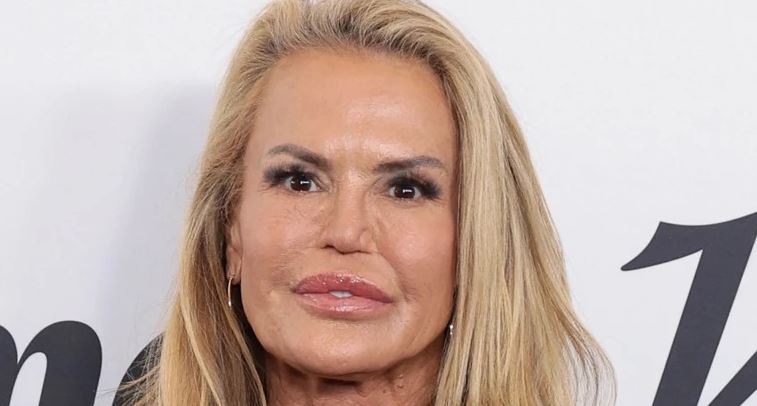 Dominique Brown's Facial Changes Over Time Linked To Car Accident