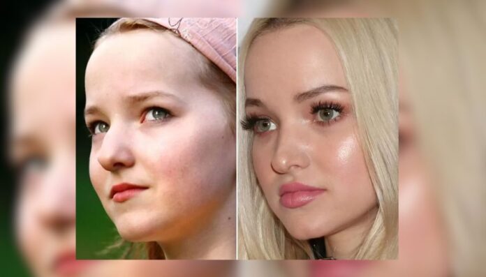 Dove Cameron Before And After Dove Cameron Before And After