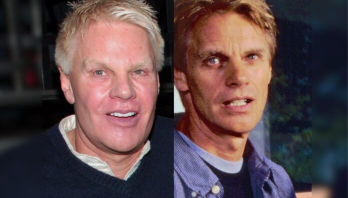 Mike Jeffries before (right) and after (left) plastic surgery Mike Jeffries before (right) and after (left) plastic surgery