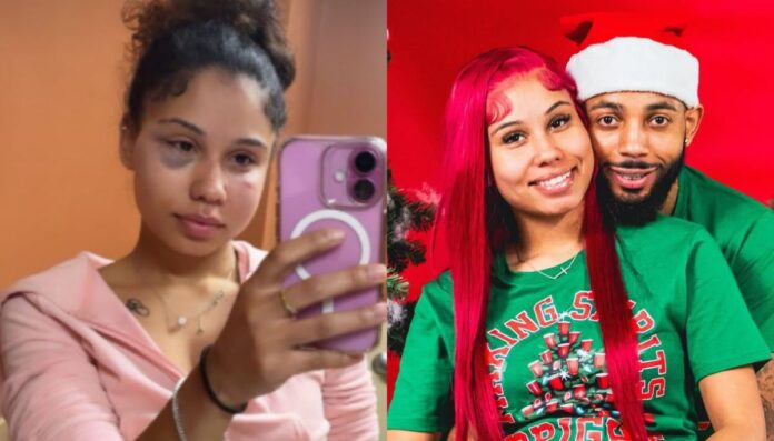 Kypree Taylor arrested Kypree Taylor has been arrested after assaulting his girlfriend