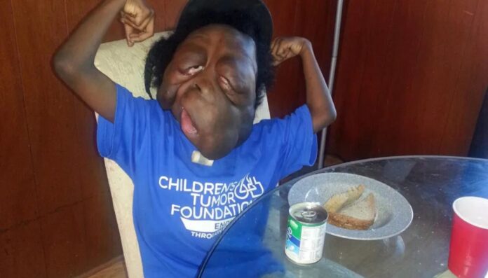 Amare Stover Is Still Alive Amare Stover Is Still Alive