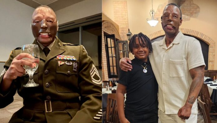 Randy Adams accident Randy Adams tragic accident in January 2021 changed his life forever